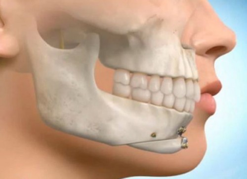 Temporomandibular joint